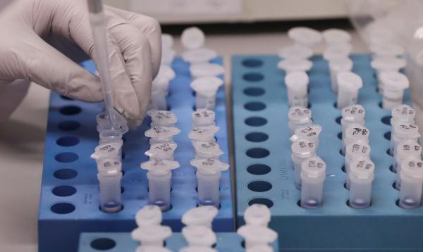 Vacina da UFRJ contra a covid-19 deve ter testes em humanos este ano
