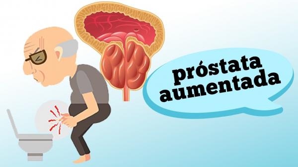 Aumento da próstata pode reduzir riscos de câncer, sugere estudo