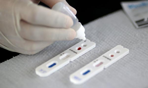 Agosto registra menor número de mortes e casos por covid no ano em MS