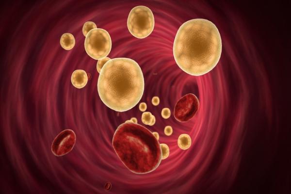 Gordura no sangue: conheça e saiba as diferenças dessas doenças