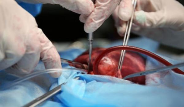 Fila do transplante de órgãos tem 428 pessoas em MS, mas recusa de famílias chega a 70%