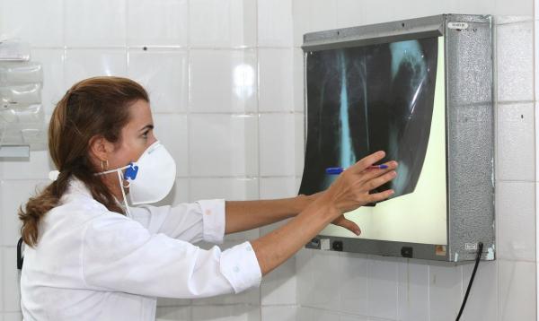 Síndromes respiratórias se aproximam de menor patamar da pandemia