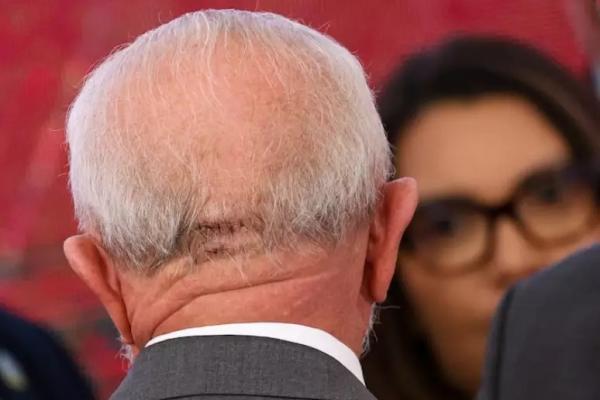 Lula é liberado para viajar de avião após novos exames