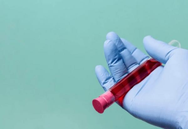 Tipo de sangue pode garantir envelhecimento mais lento e vida mais longa