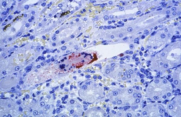 Conheça o Nipah, vírus altamente letal que deixou a Ásia em alerta